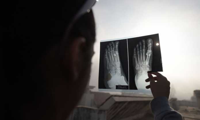 Dunyo bo'ylab quyosh tutilishi suratlarda Dunyo bo'ylab quyosh tutilishi suratlarda