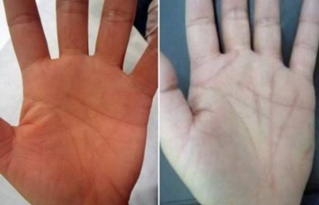 Qiziqarli ma'lumotlar: Go'zallik qurbonlik talab qiladi (+foto)