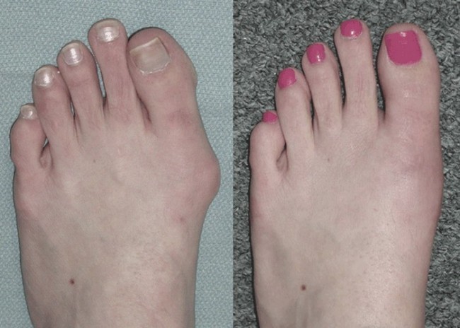 Qiziqarli ma'lumotlar: Go'zallik qurbonlik talab qiladi (+foto)