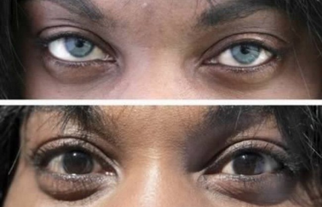 Qiziqarli ma'lumotlar: Go'zallik qurbonlik talab qiladi (+foto)