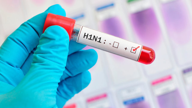 Minglab odamlarning hayotiga zomin bo'lgan XXI asrning eng xatarli epidemiyalari Minglab odamlarning hayotiga zomin bo'lgan XXI asrning eng xatarli epidemiyalari