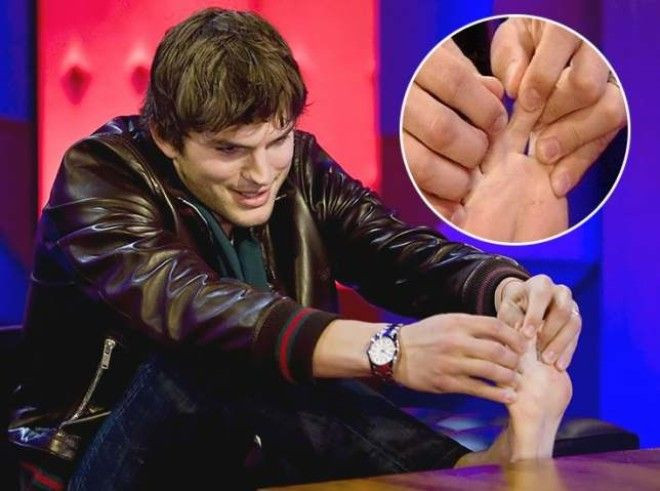 Mashhur yulduzlarning siz bilmagan kichik nuqsonlari (foto)