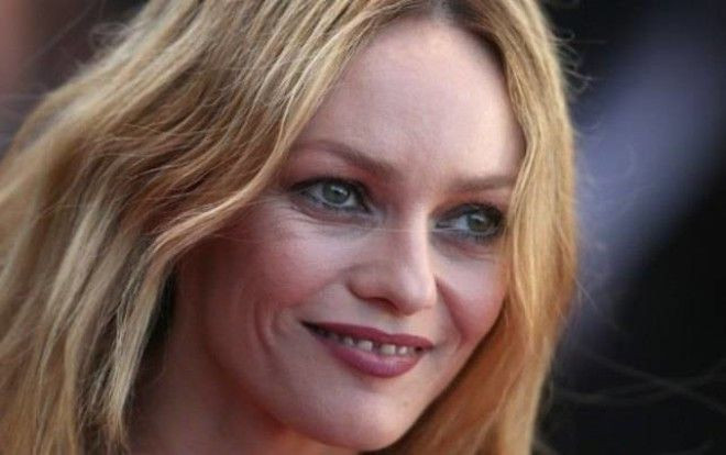 Mashhur yulduzlarning siz bilmagan kichik nuqsonlari (foto)