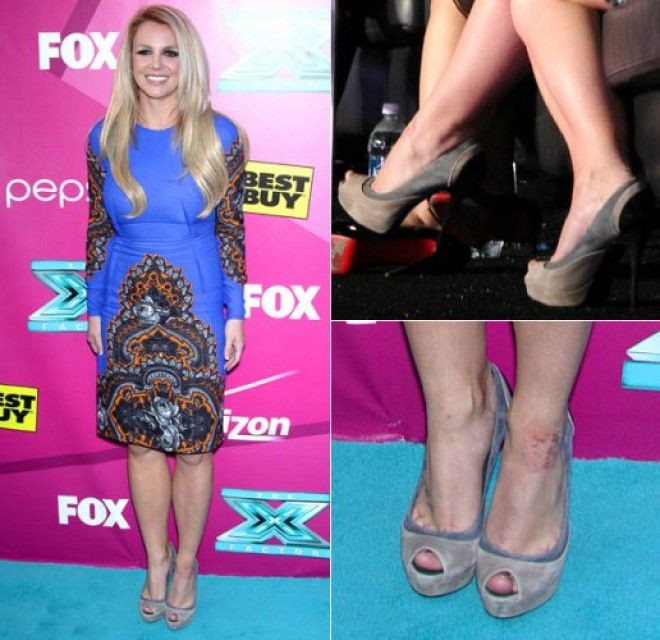 Mashhur yulduzlarning siz bilmagan kichik nuqsonlari (foto)