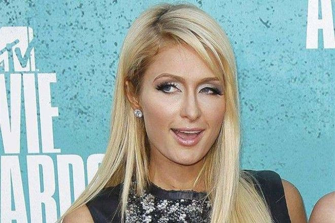 Mashhur yulduzlarning siz bilmagan kichik nuqsonlari (foto)