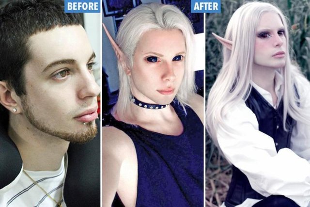 29 yoshli yigit elfga o'xshab ko'rinishi uchun 32 ta plastik operatsiya o'tkazdi (foto) 29 yoshli yigit elfga o'xshab ko'rinishi uchun 32 ta plastik operatsiya o'tkazdi (foto)