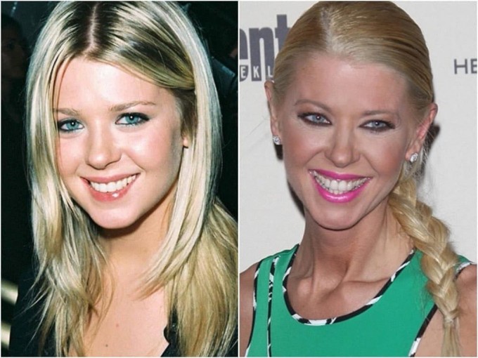 Keskin ozish natijasida bir necha yoshga qarigan yulduzlar (foto)