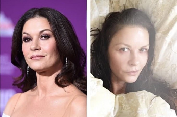 Keskin ozish natijasida bir necha yoshga qarigan yulduzlar (foto)