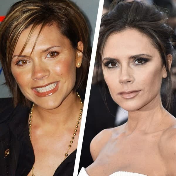 Keskin ozish natijasida bir necha yoshga qarigan yulduzlar (foto)