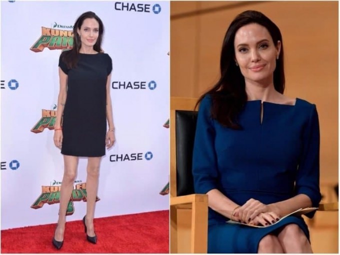 Keskin ozish natijasida bir necha yoshga qarigan yulduzlar (foto)