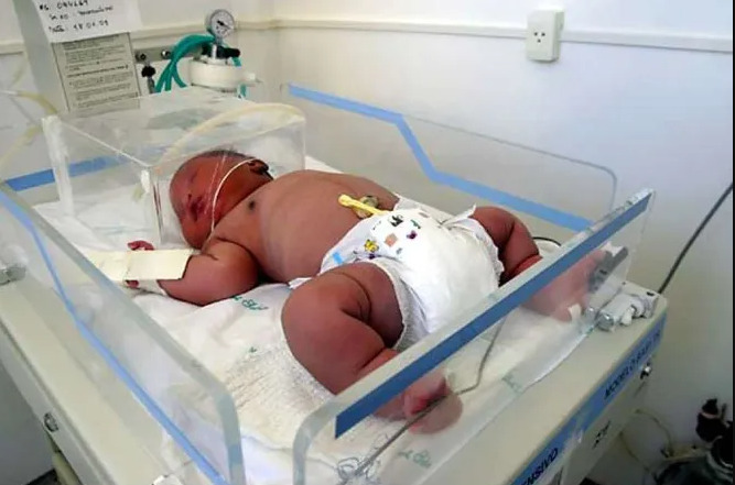 Dunyodagi eng katta vazn bilan tug'ilgan chaqaloqlar (+foto) Dunyodagi eng katta vazn bilan tug'ilgan chaqaloqlar (+foto)