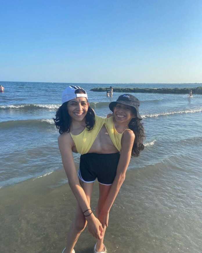 Meksikalik 22 yoshli siam-egizaklari Lupita va Karmen noodatiy tug'ilgani sababli dunyoga mashhur bo'lgan Meksikalik 22 yoshli siam-egizaklari Lupita va Karmen noodatiy tug'ilgani sababli dunyoga mashhur bo'lgan