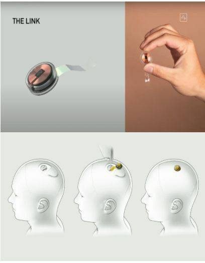 Ilon Maskning «Neuralink» kompaniyasi odamlarning miyasiga o'rnatiladigan chipni sinab ko'rish uchun ko'ngillilarni qidirmoqda