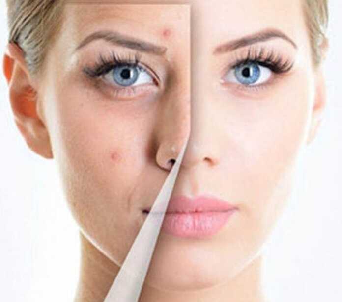 Husnbuzar keltirib chiqaruvchi 5 asosiy sabab