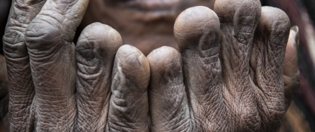 Barmog‘i kesiladigan ayollar, og‘riqli erkaklik sinovi va axlatga belangan kelin-kuyov: dunyodagi eng g‘alati an’analar Barmog‘i kesiladigan ayollar, og‘riqli erkaklik sinovi va axlatga belangan kelin-kuyov: dunyodagi eng g‘alati an’analar1