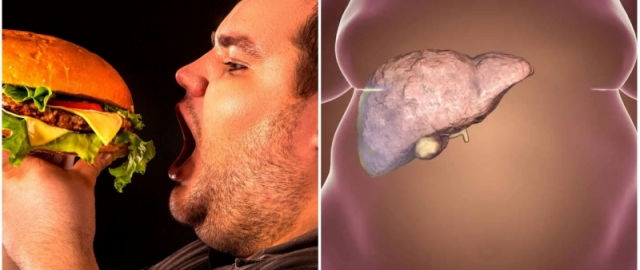 Fastfud – zarar. Xo‘sh, nega? Fastfud – zarar. Xo‘sh, nega?9