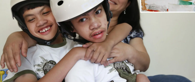 Ikki bosh bitta tana: eng matonatli 9 siam egizagi Ikki bosh bitta tana: eng matonatli 9 siam egizagi13