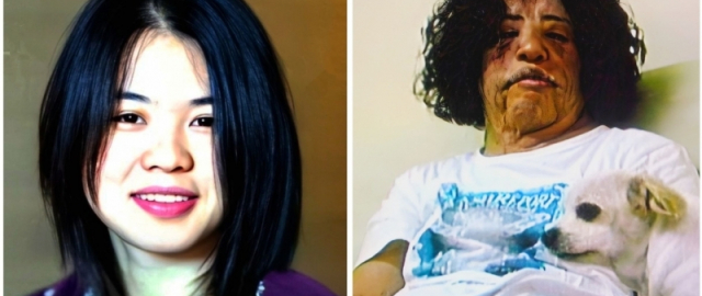 Supermodel va aktrisalar: omadsiz plastik jarrohlik qurbonlari2