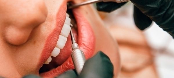 Odamlarning stomatologdan qo‘rqish sababi aniqlandi