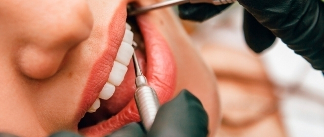 Odamlarning stomatologdan qo‘rqish sababi aniqlandi